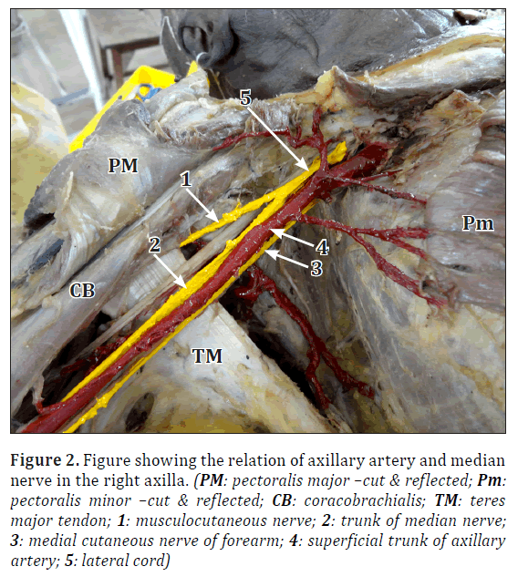anatomical-variations-axillary-artery