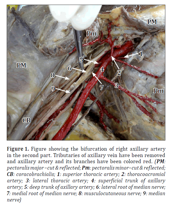 anatomical-variations-axillary-vein