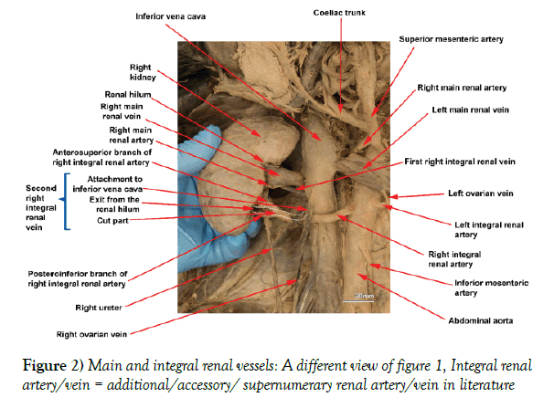 anatomical-variations-integral-renal