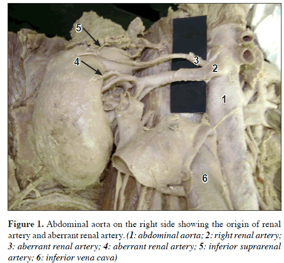 anatomical-variations-renal-aorta