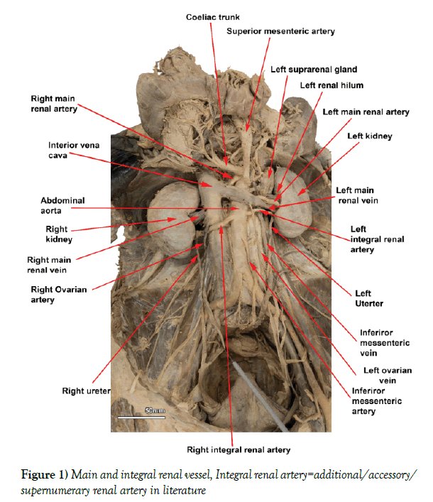 anatomical-variations-renal-vessel