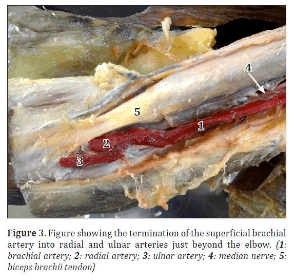 anatomical-variations-superficial-brachial