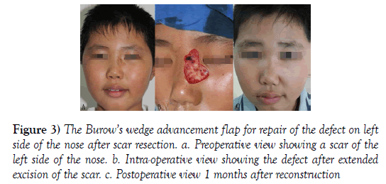 surgery-case-report-Preoperative-view